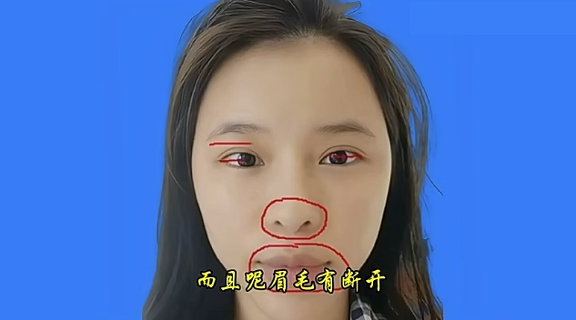 8整容失败的案例！